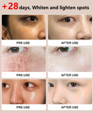 Niacinamide Purifying Whitening Cleanser(BUY 1 GET 1 FREE)